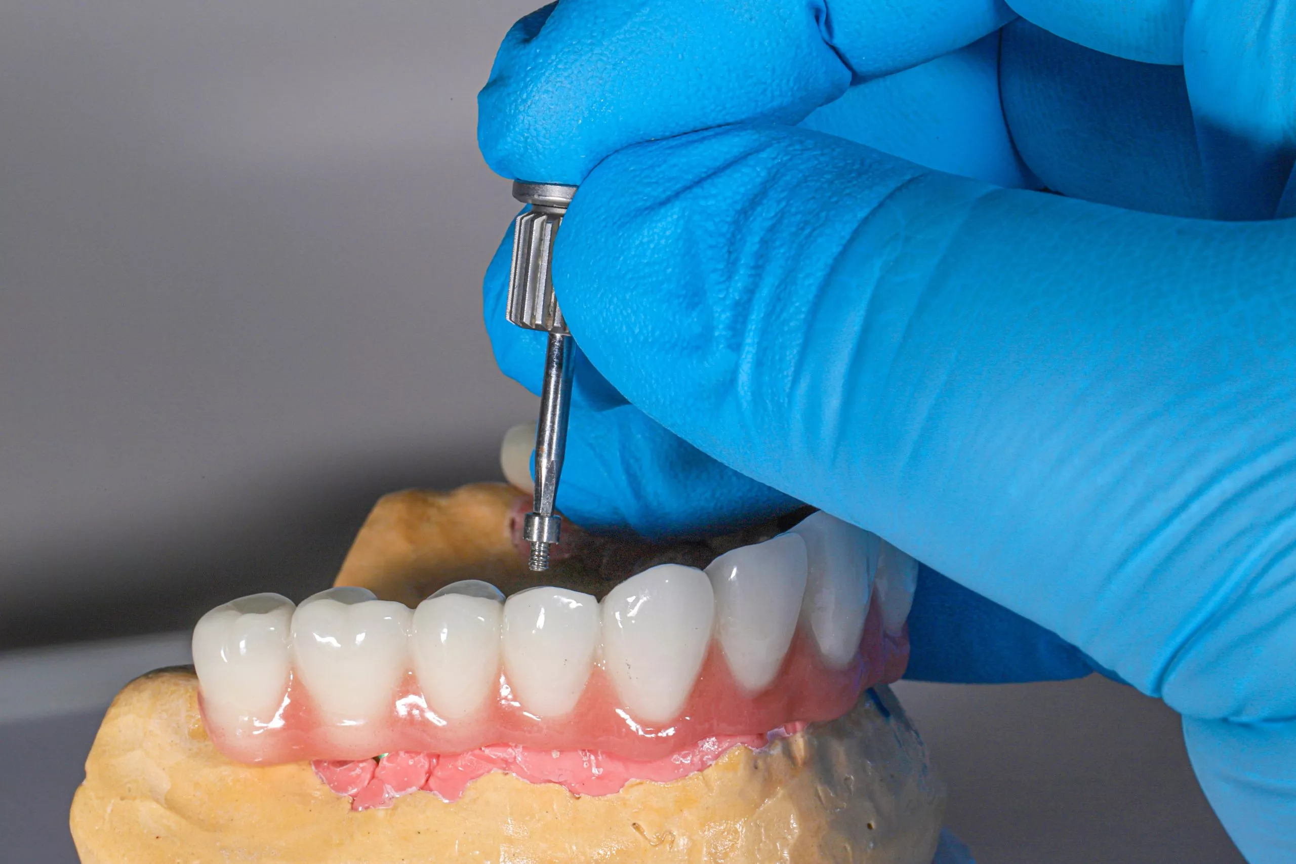 Bone Graft Materials for Dentistry: Which Type Is Right for You?