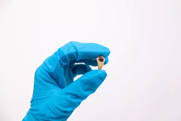 Essential Tips for Hudson Patients to Speed Healing and Avoid Complications After Wisdom Teeth Removal