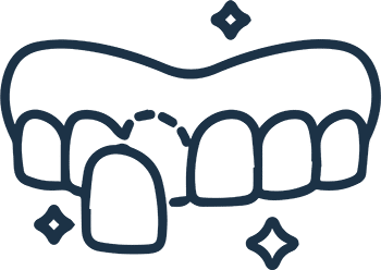 Cosmetic Veneers in Kirkland, WA 1 Veneers Kirkland, WA Near Me