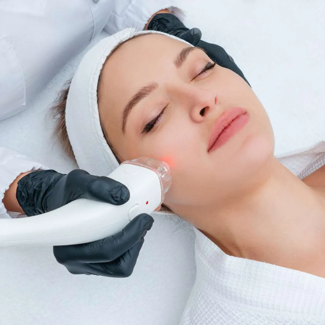 Venous Lake Treatment at Las Vegas Skin Pros Face Treatment - Las Vegas Skin Pros | Med Spa Venous Lake Treatment at Las Vegas Skin Pros Face Treatment