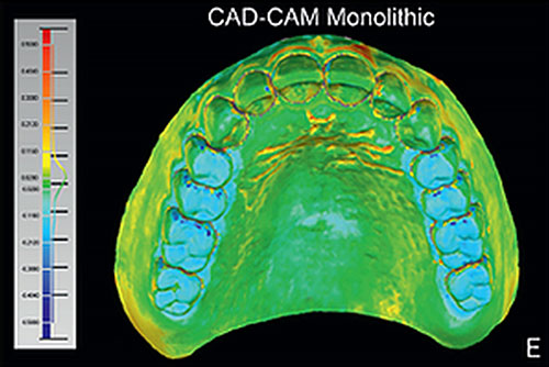 Digital Dentures Tri-Cities, WA | Columbia Basin Denture Care