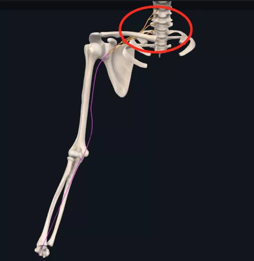 Brachial Plexus circled in red