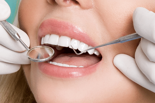 Transform Your Smile: The Beauty and Versatility of Dental Veneers 2 Patient undergoing dental veneers procedure.