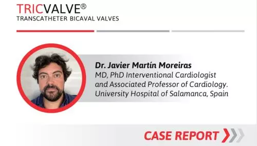 Headshot of Dr. Javier Martรญn Moreiras MD, PhD Interventional Cardiologist and Associated Professor of Cardiology. University Hospital of Salamanca, Spain