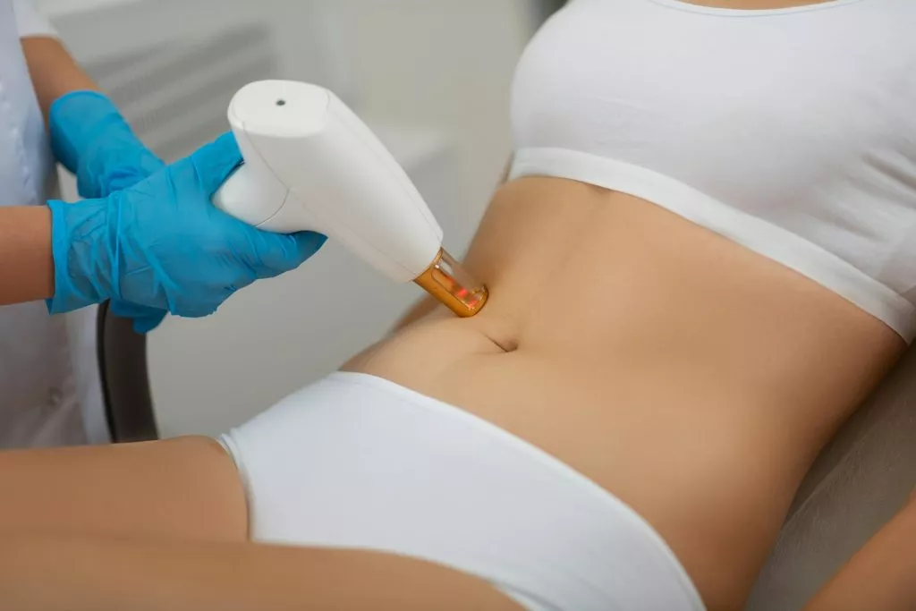 Liposuction