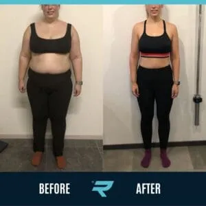 "I lost a remarkable 40kg, Reshape truly saved my life"
