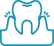 Gum-Disease