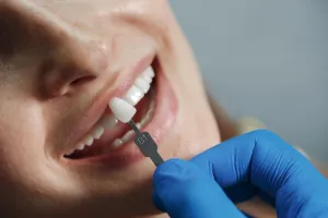 Not Ready for Implants Bridges Are Still a Solid Option