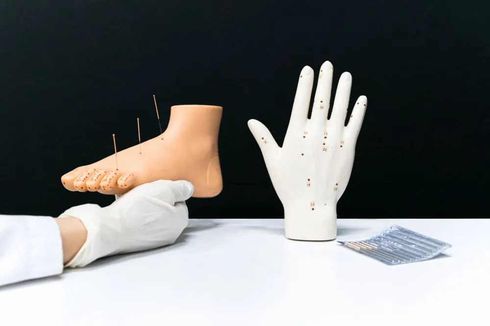 Botox for Chronic Migraines in Grand Prairie, TX 1 Acupuncture needles used in integrative medicine for chronic pain relief