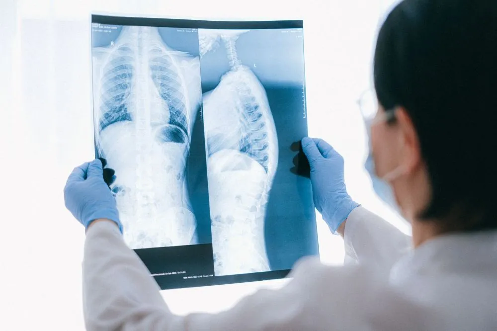 Chronic Low Back Pain: Is Your Treatment Worth the Risk? 1 Pain management doctor reviewing spine MRI scan with patient in clinic consultation