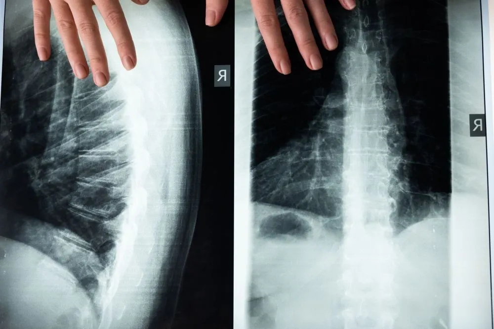 Chronic Low Back Pain: Is Your Treatment Worth the Risk? 2 Physical therapist guiding patient through lumbar spine exercises for back pain relief