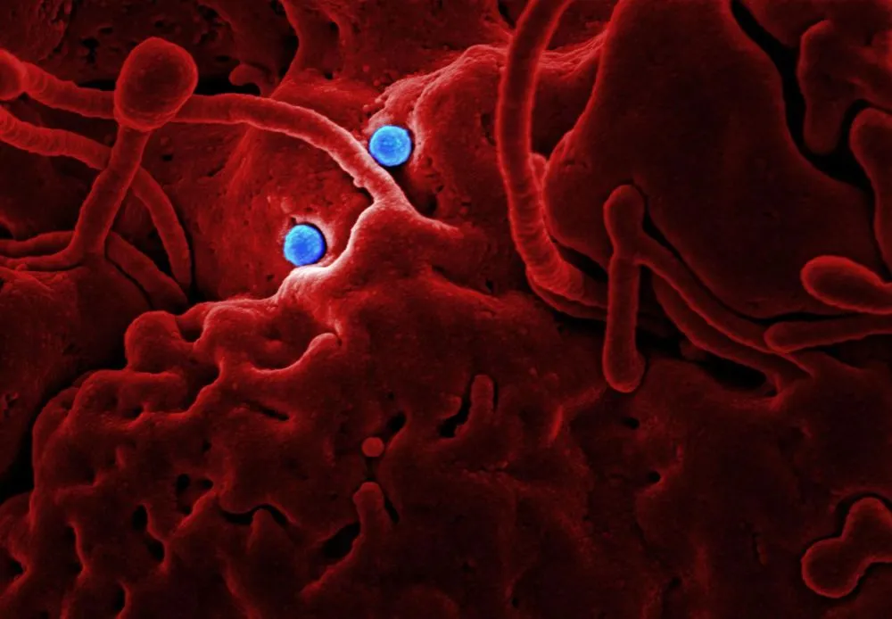 Group Therapy & Stem Cell Care for Chronic Pain in Plano, TX 1 Medical illustration of sickle-shaped red blood cells associated with chronic pain