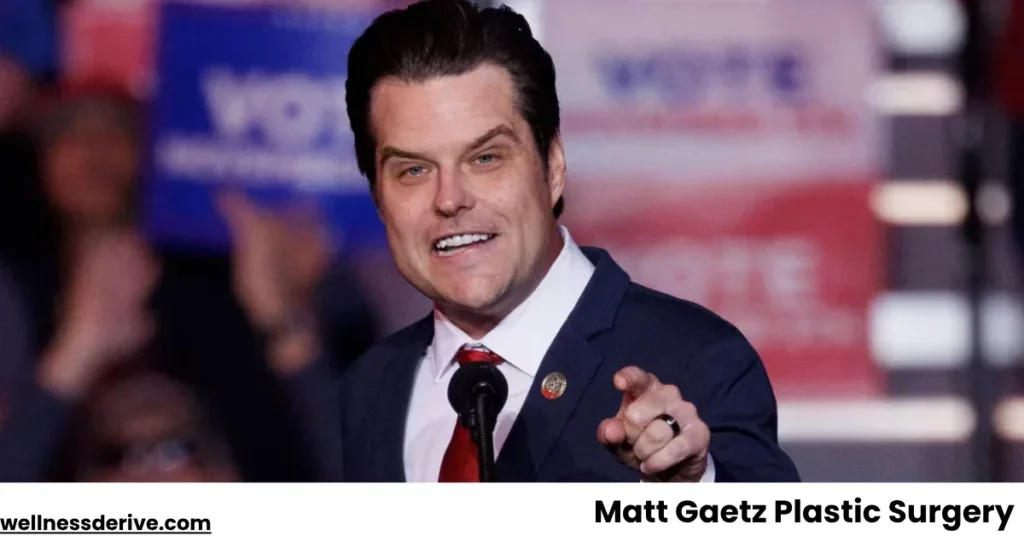 Matt-Gaetz-Plastic-Surgery-1024x536.webp