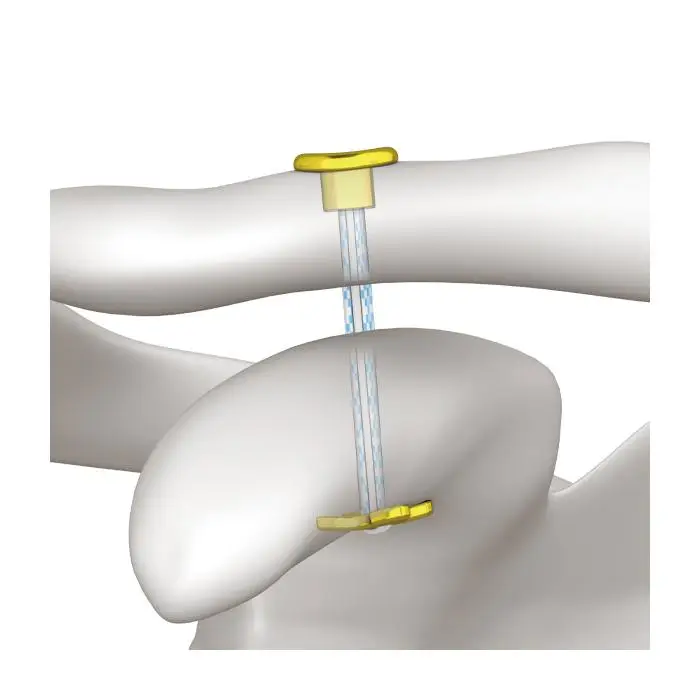 Buy Best Sport Medicine,Orthopaedics Suppliers,Suture Anchor