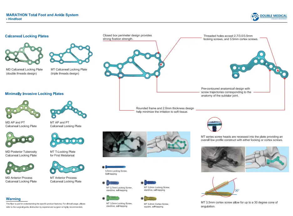MD Anterior Process Calcaneal Locking Plate 1 MD Anterior Process Calcaneal Locking Plate is used for Calcaneal anterior process fracture.