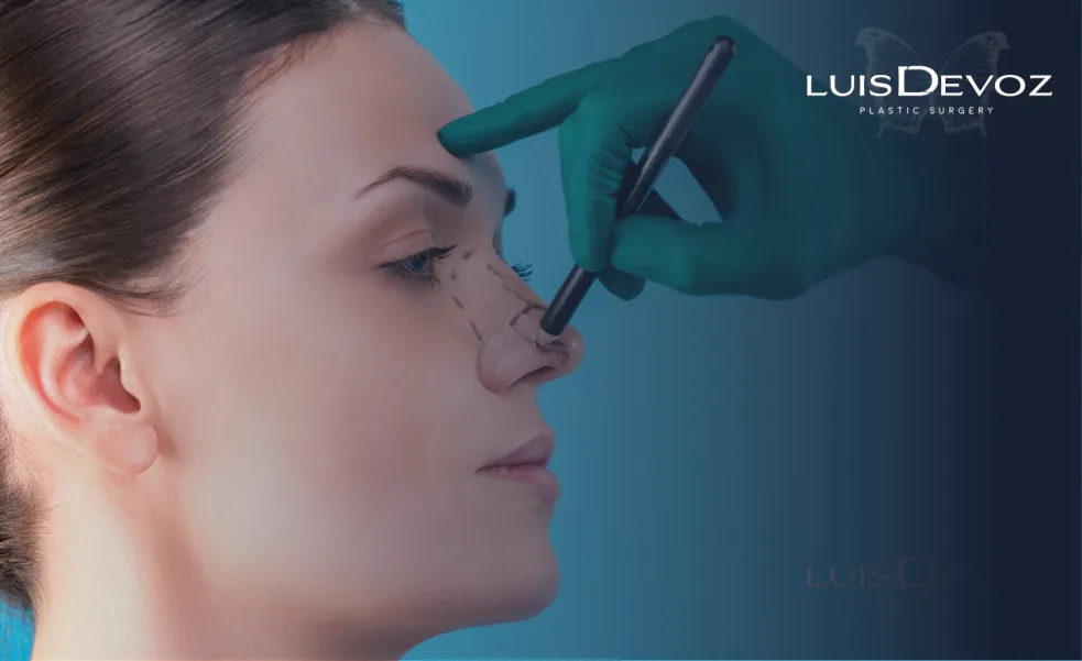 ¿Soy candidato para rinoplastia? Dr. Luis Devoz