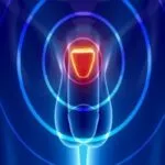 Προστατίτιδα προστατίτιδα