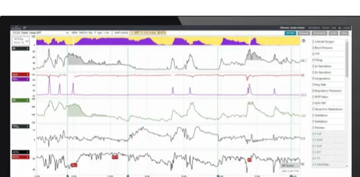 risk analysis screen