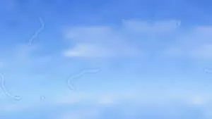 Floaters in the eye, medical symptom in optics