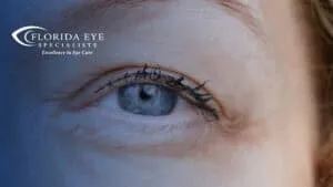 photograph of a blonde women's blue eye. The image has a blue shadow overlay with the Florida Eye Specialists logo in the top left corner.