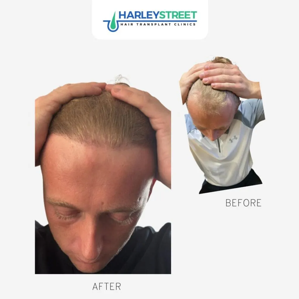 Jack Before & Afters