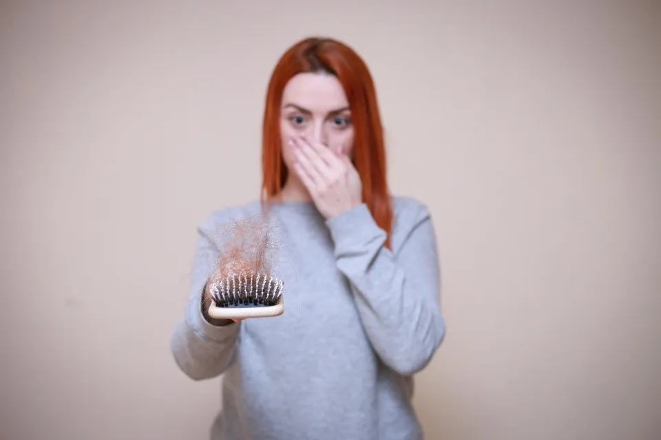 8 Natural Remedies for Hair Loss Free photos of Hair loss