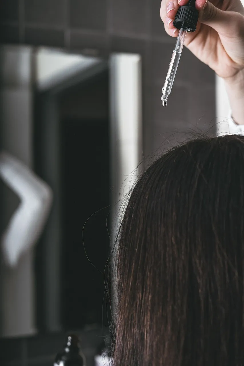 Retrograde Alopecia Free Hair Hair Loss photo and picture