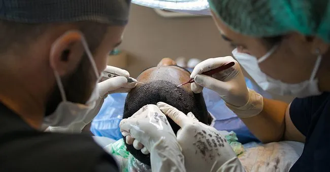 Hair Transplant for Scar Repair Hair Transplant, Treatment, Surgery