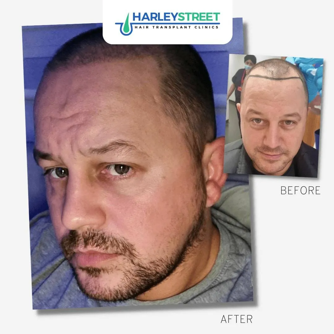 Home page SB 8 FUE-Before-and-After-13
