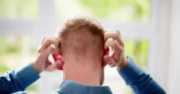 Hair Transplant Itching Hair transplant itching