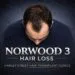 Norwood 3 Norwood 3 scale hair loss