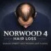 Norwood 4 Scale Norwood 4 scale hair loss