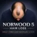 Norwood 5 Norwood 5 on the hair loss scale