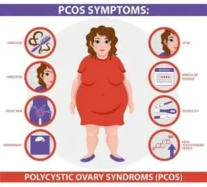 Illnesses That Cause Hair Loss in Women PCOS and hair loss