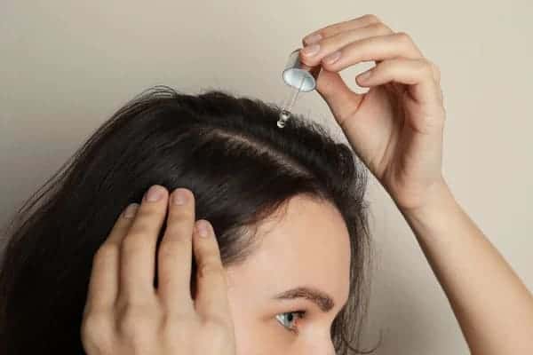 Azelaic Acid for Hair Loss azelaic acid for hair loss and growth