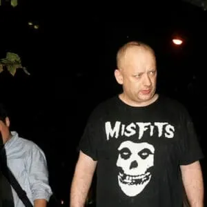 Boy George Hair Transplant boy george with hair loss