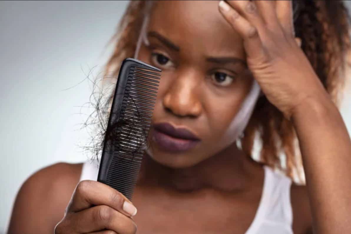 Hair Loss in Black Women hair loss in black women