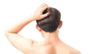 Hair Transplant Itching itchy scalp after a hair transplant procedure