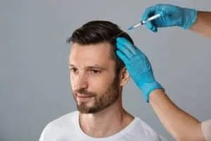 PRP vs Topical Finasteride and Minoxidil Combo man doing prp on head for hair loss