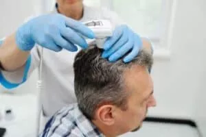 Does Shampoo Cause Hair Loss? man with hair loss under trichoscope exame