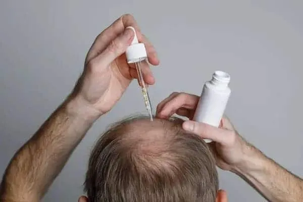Stemoxydine for Hair Loss stemoxydine for hair loss