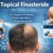 Topical Finasteride Side Effects topical finasteride side effects