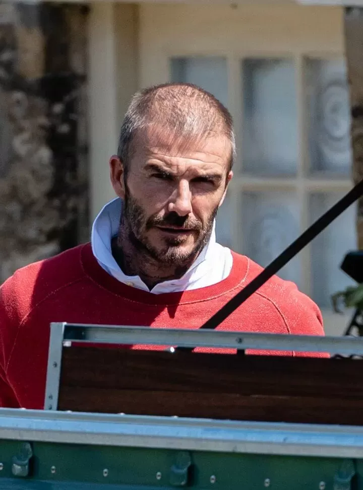 David Beckham Hair Transplant david beckham hair loss
