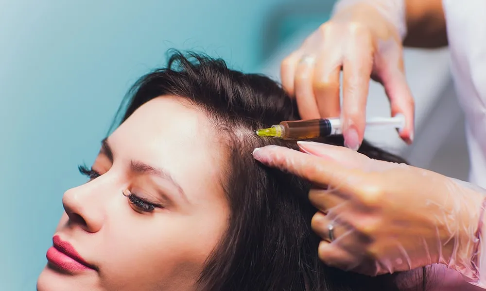 PRP Hair Treatment 2 prp hair treatment nottingham image