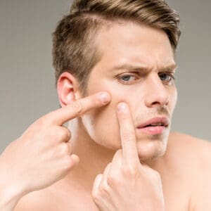Γίνε εξολοθρευτής 4 pimples man