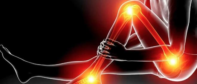 SCIATICA