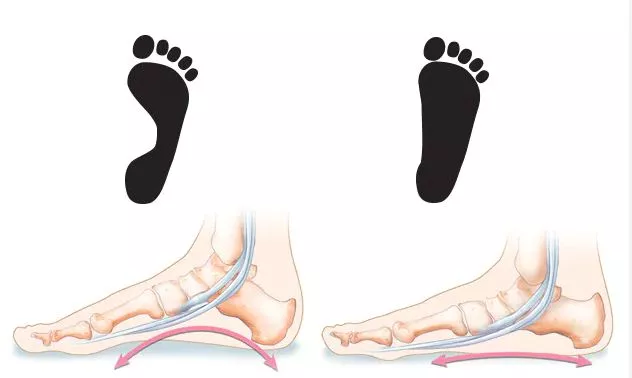 Πλατυποδία ασκήσεις 5 flatfeet