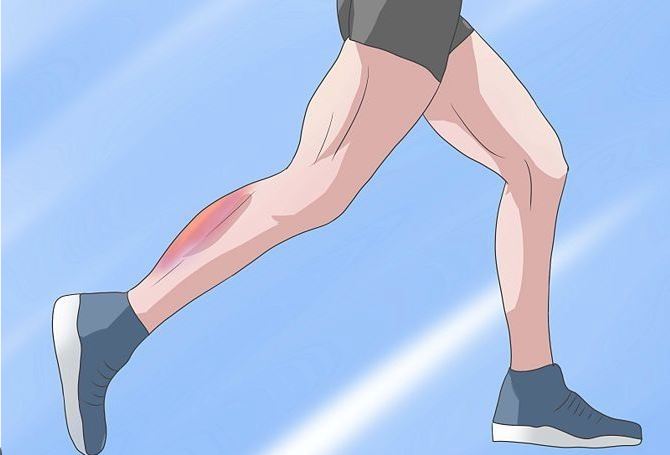 lactic acid 1