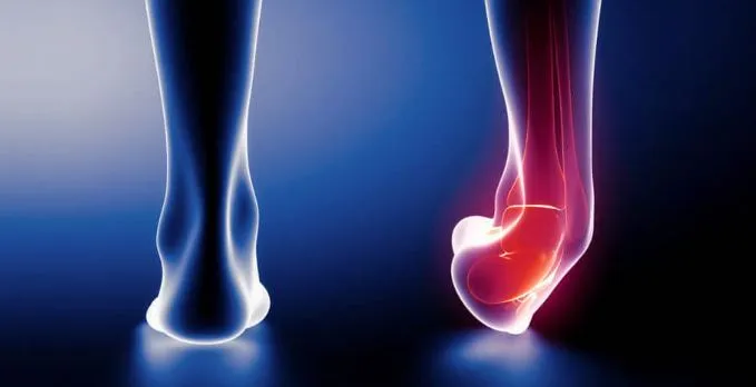 10 ασκήσεις για διάστρεμμα αστραγάλου 5 ankle sprain