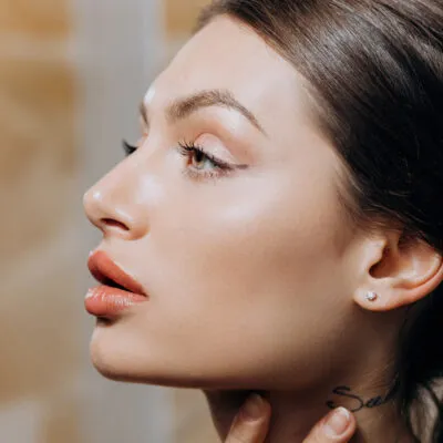 Dysport® 60 Units (Softer than Botox® look)
